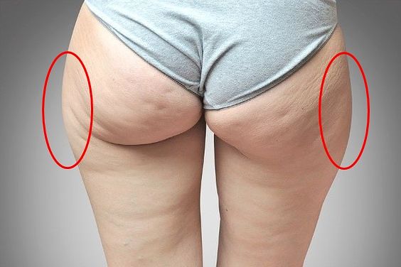 描述: D:\廣編\網文\居家運動-改善假胯寬\04a285aa90215344160a6070ca4b0803.jpg